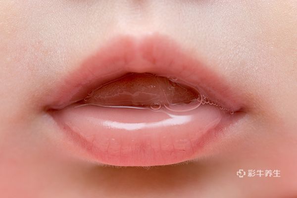 小孩嘴唇起泡图片 小孩嘴唇起泡是什么原因