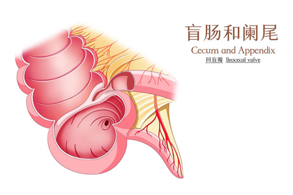 阑尾炎6003.jpg