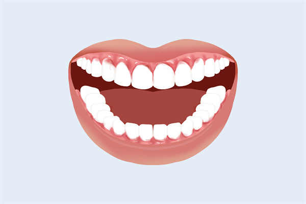 牙龈癌的早期三大症状 牙龈癌的症状