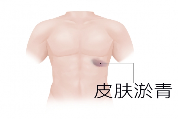 氩弧焊对身体有什么危害 氩弧焊对身体的潜在危害